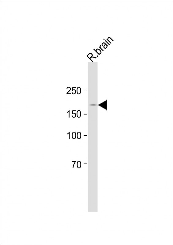 WB - BZRAP1 Antibody (C-term) AP21258b