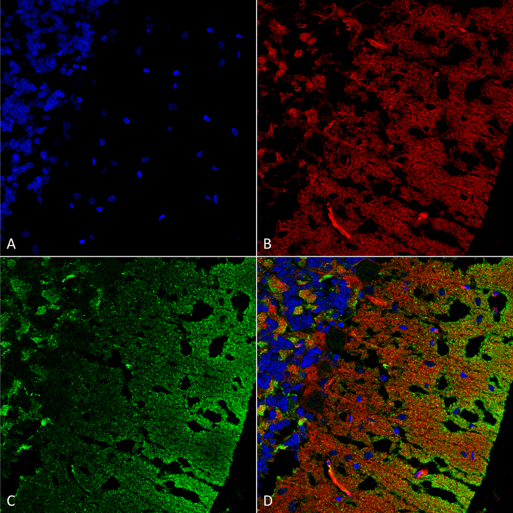 IHC - Alpha Synuclein Antibody ASM10655