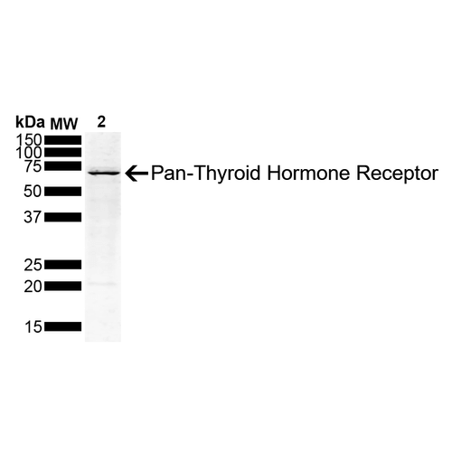 WB - Thyroid Hormone Receptor Antibody ASM10686