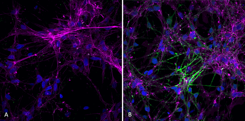  - Alpha Synuclein Antibody (pSer129) ASM10689