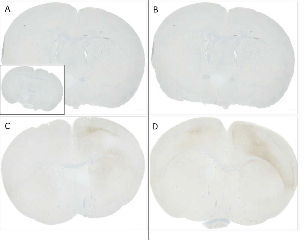 IHC - Alpha Synuclein Antibody (pSer129) ASM10689