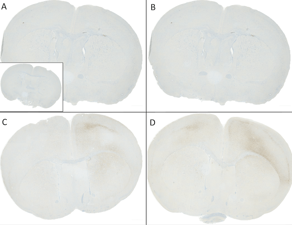 IHC - Alpha Synuclein Antibody (pSer129) ASM10689