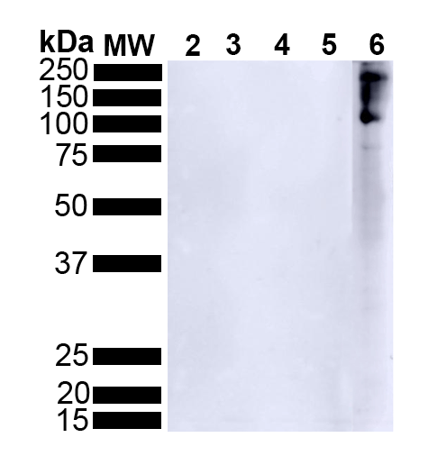 WB - Alpha Synuclein Antibody (pSer129) ASM10689