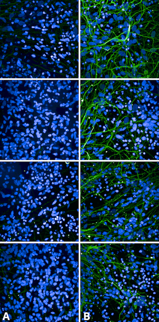  - Tau Antibody (pSer202/ pThr205) ASM10690