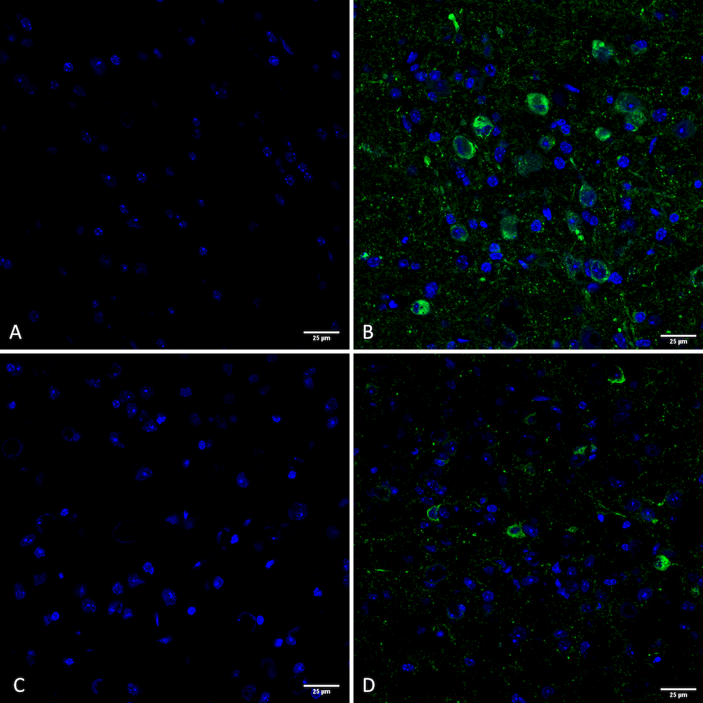 IHC - Tau Antibody (pSer202/ pThr205) ASM10690