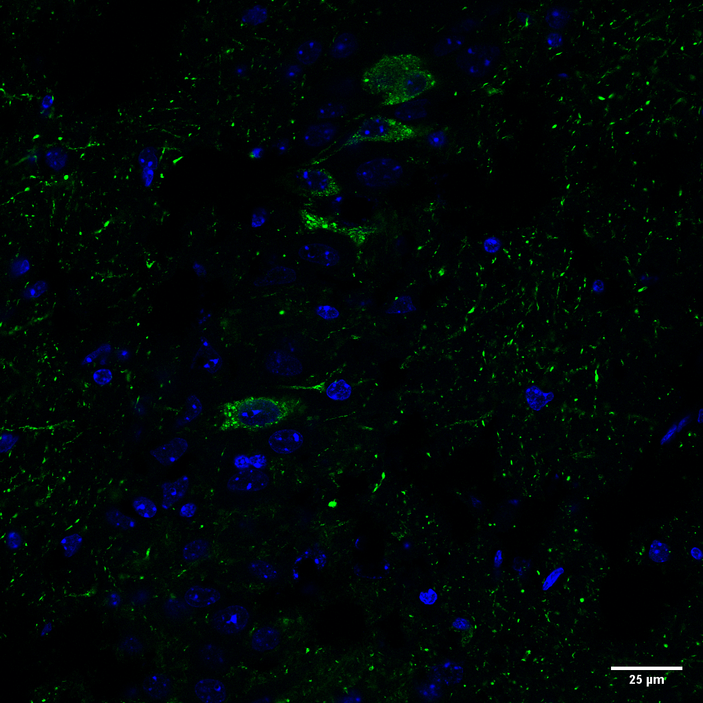 IHC - Tau Antibody (pSer202/ pThr205) ASM10690