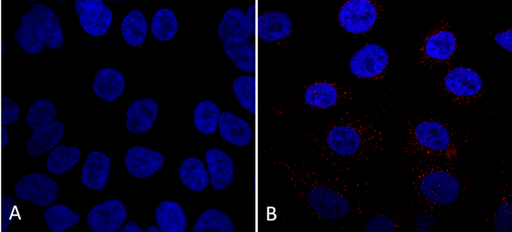  - VPS35 Antibody ASM10691
