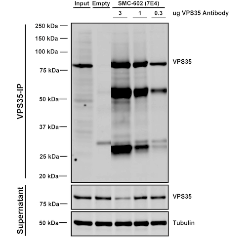 IP - VPS35 Antibody ASM10691