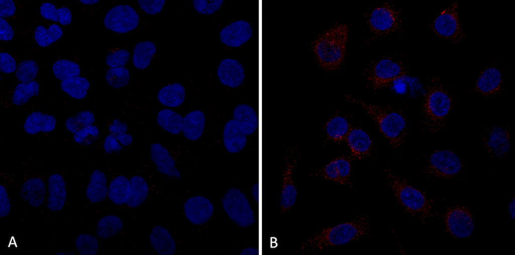  - VPS35 Antibody ASM10694
