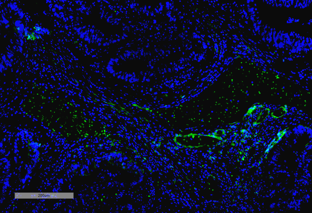 IHC - VPS35 Antibody ASM10694