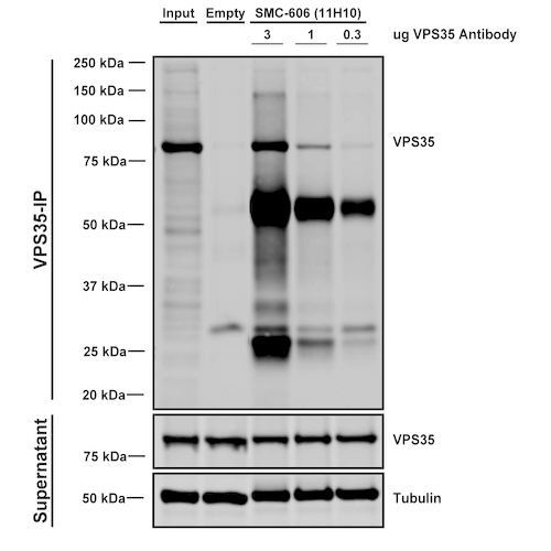 IP - VPS35 Antibody ASM10695