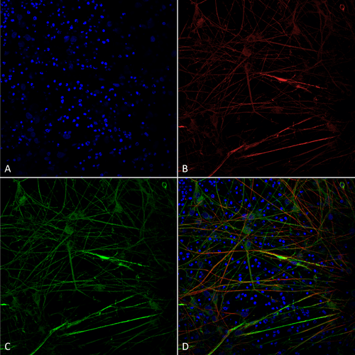  - Tau Antibody ASM10696
