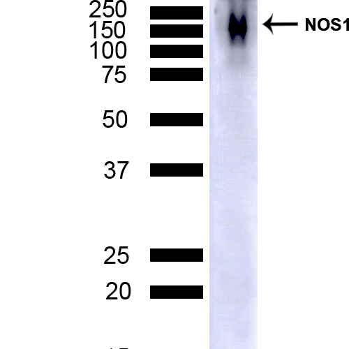 WB - NOS1/ nNOS Antibody ASM10698