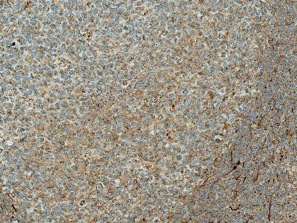  - TCF7L2 Antibody ASM10571