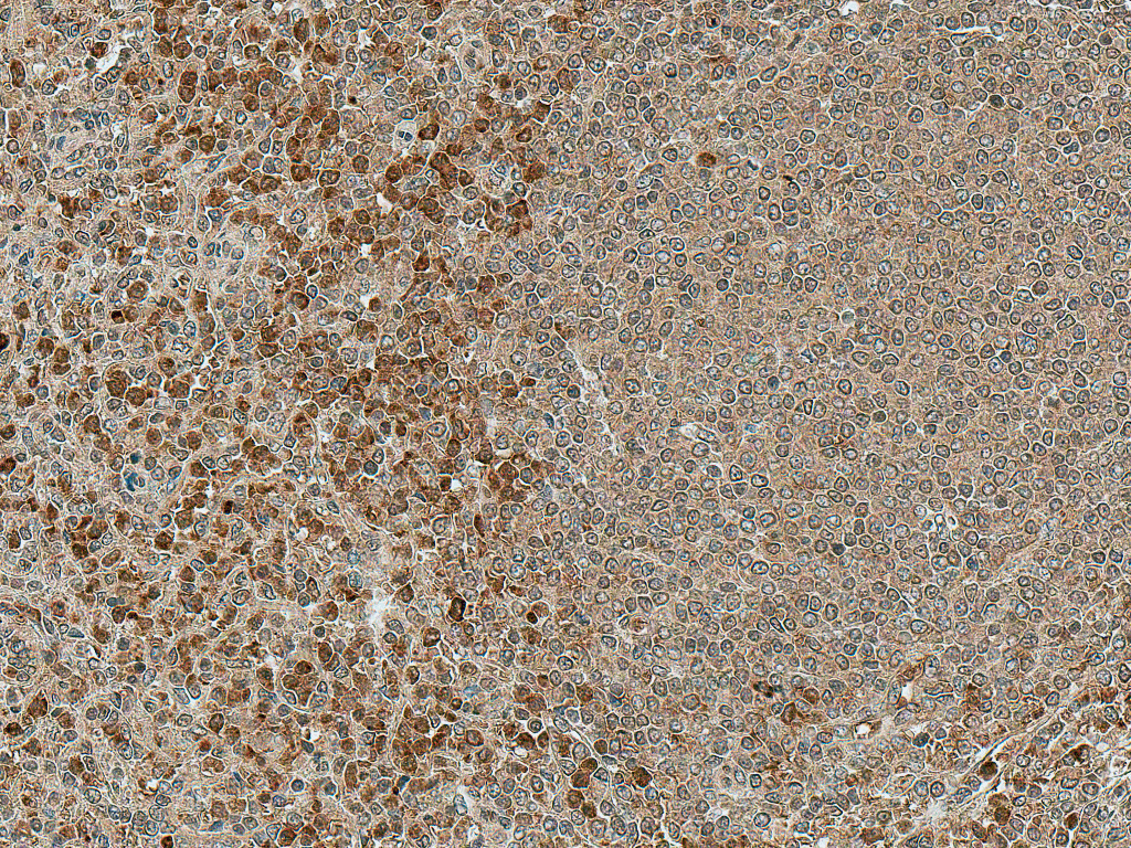  - NFATC1 antibody ASM10576