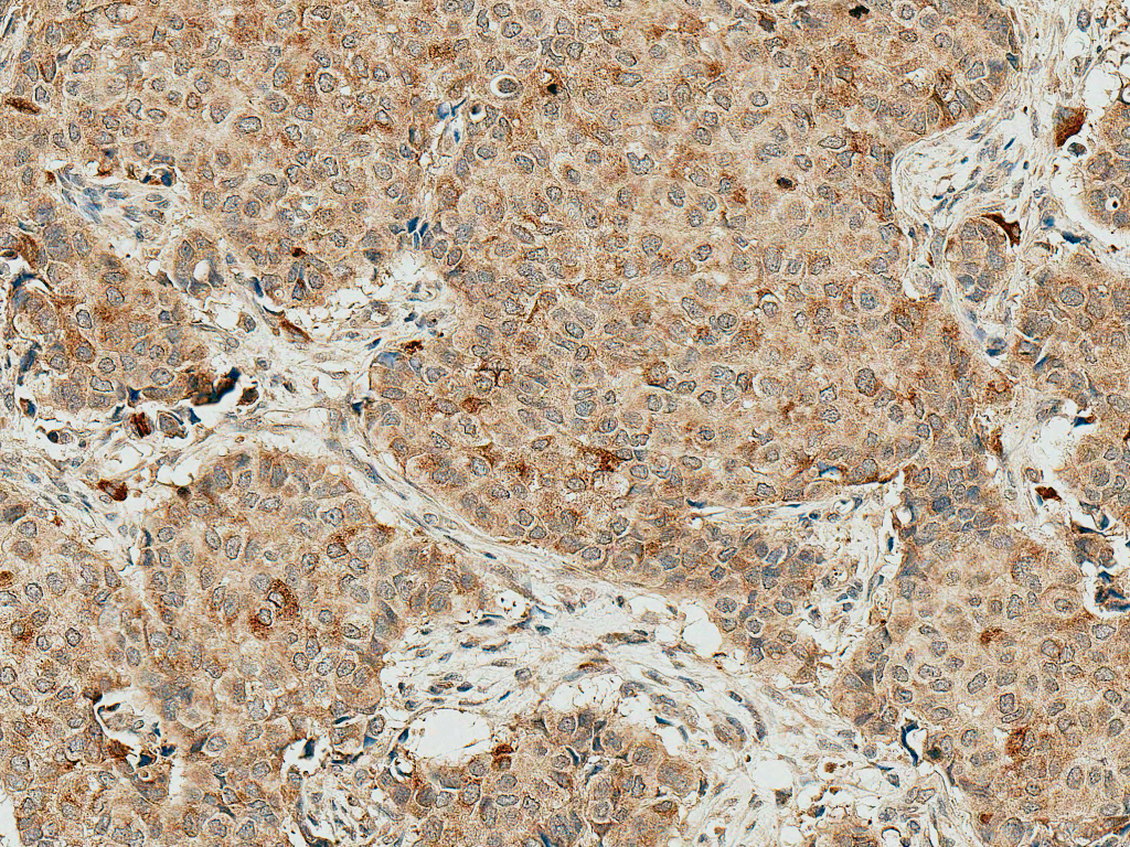  - SMAD4 Antibody ASM10579