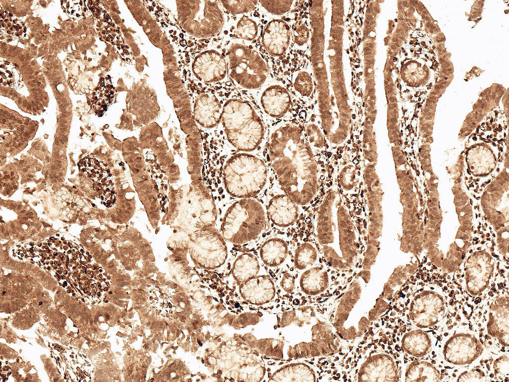  - Cyclin D2 antibody ASM10582