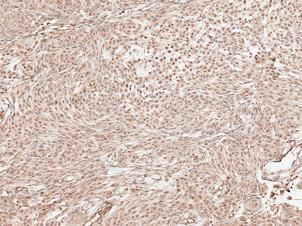  - Presenilin 1 Antibody ASM10583