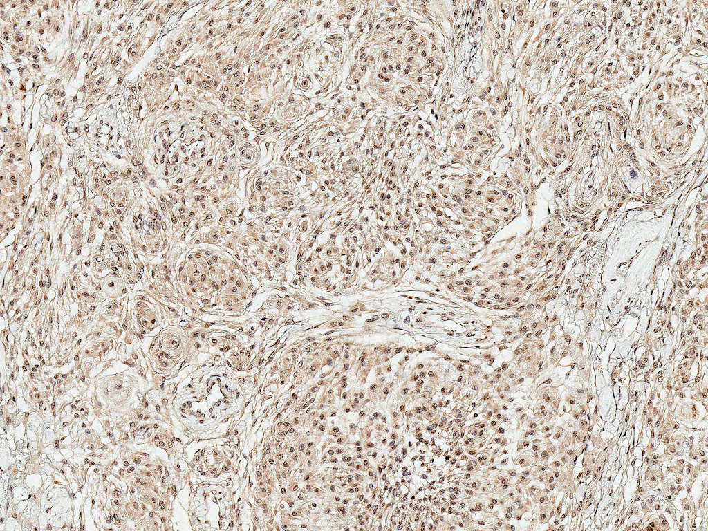  - TAK1 Antibody ASM10585