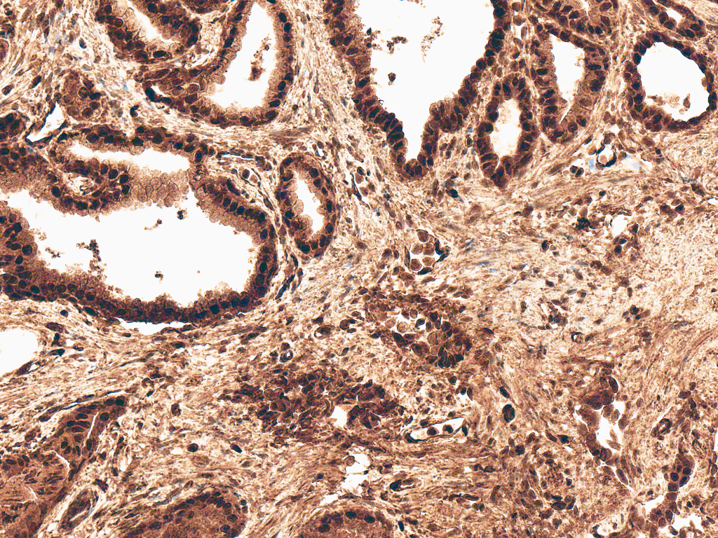  - ROR2 Antibody ASM10588