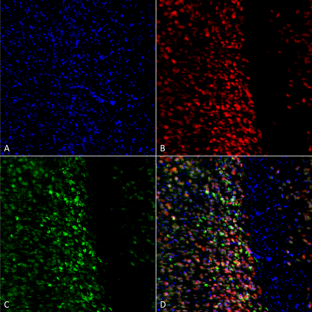  - Alpha Synuclein Antibody (pSer129) ASM10591