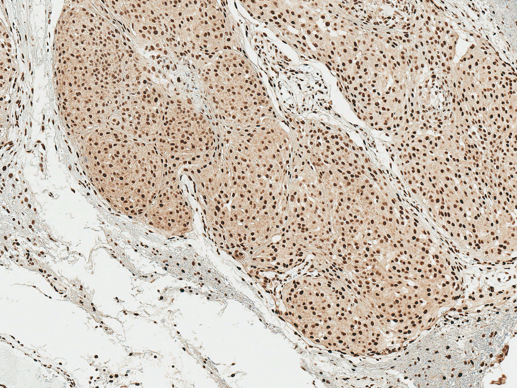  - Alpha Synuclein Antibody (pSer129) ASM10591