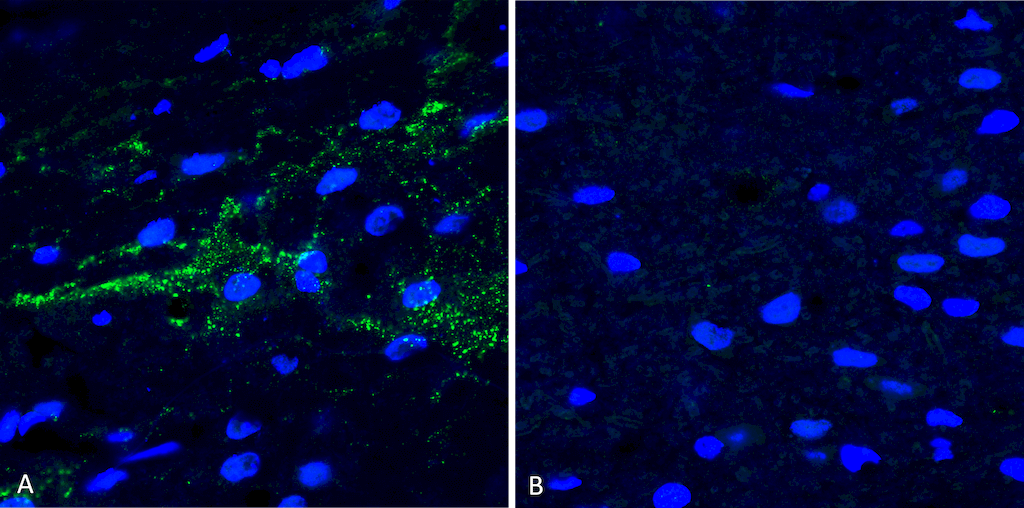  - Alpha Synuclein Antibody (pSer129) ASM10591