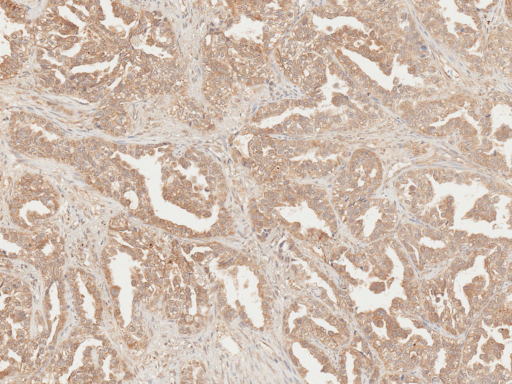  - Axin-2 Antibody ASM10598
