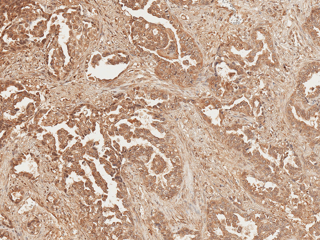  - Axin-2 Antibody ASM10599
