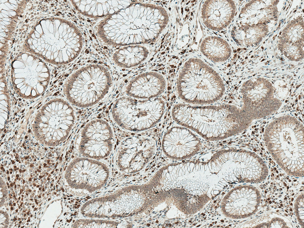  - SMAD3 Antibody ASM10603