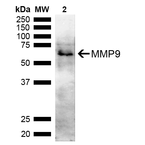 - MMP9 Antibody ASM10605