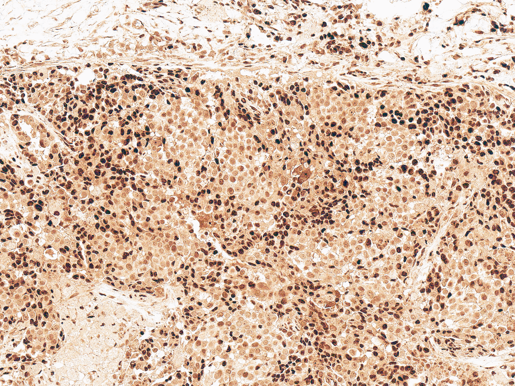  - GSK3 beta Antibody ASM10607