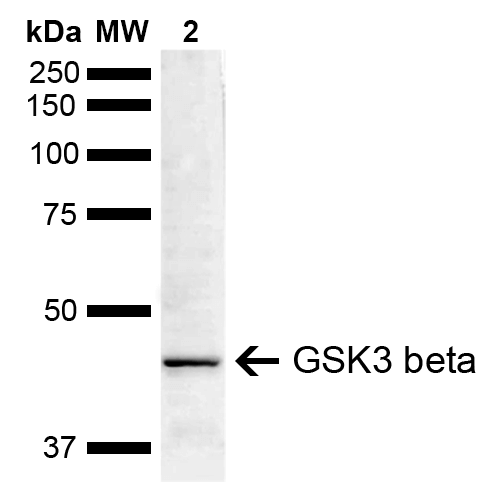  - GSK3 beta Antibody ASM10607