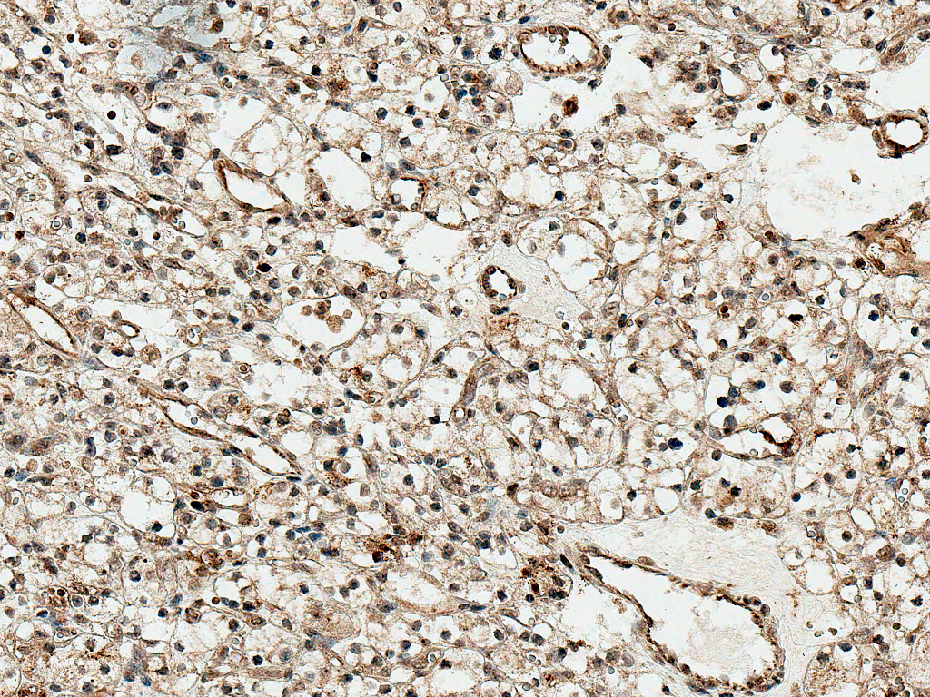  - SFRP1 Antibody ASM10614