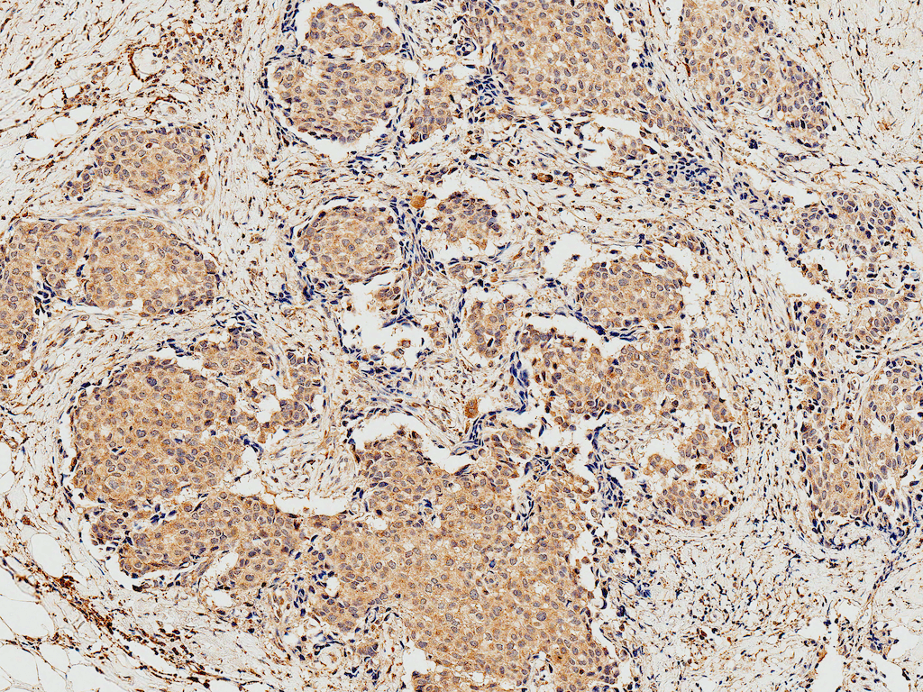 - 4EBP1 Antibody ASM10630
