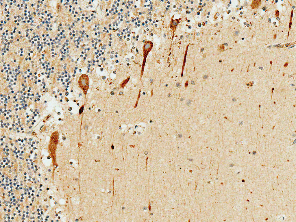  - PKC gamma Antibody ASM10631