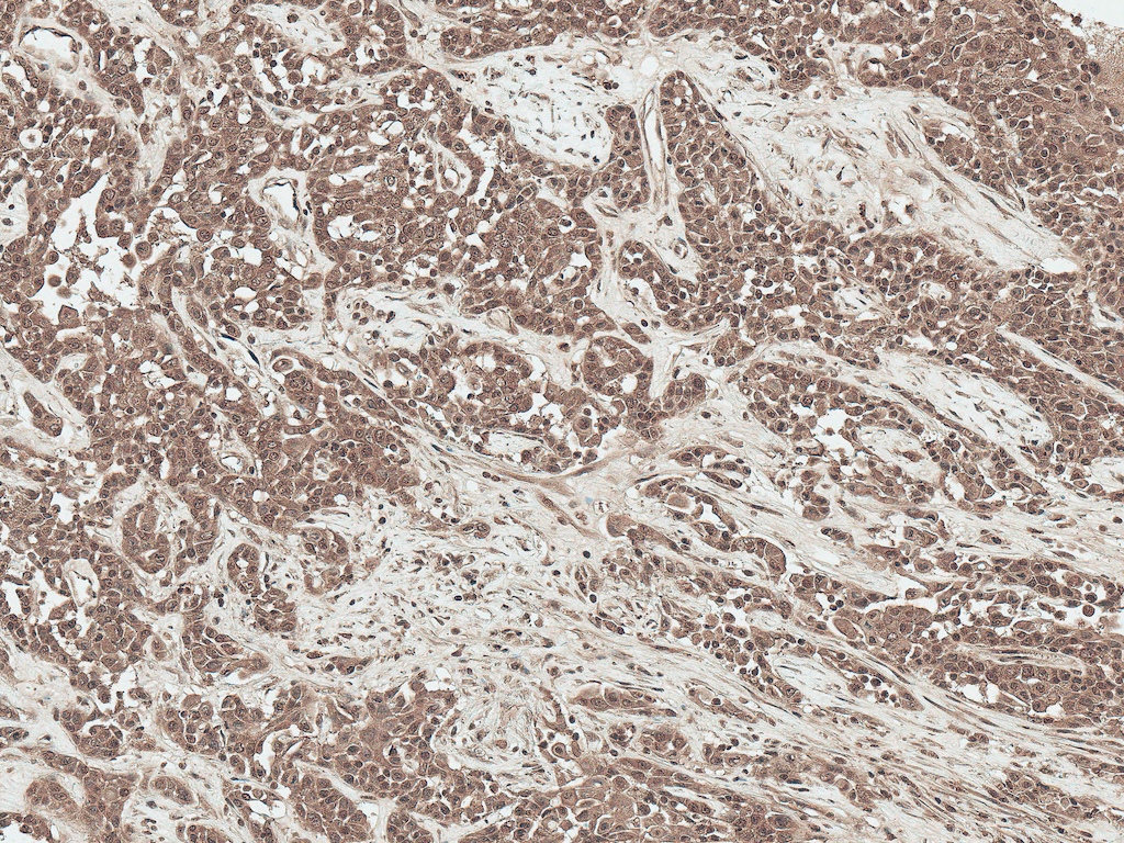  - SFRP2 Antibody ASM10635