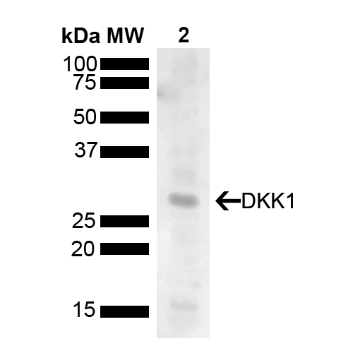  - DKK1 Antibody ASM10636