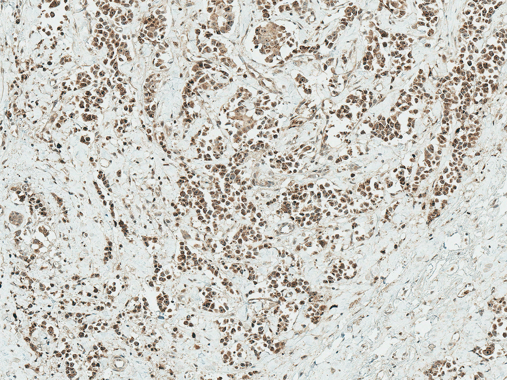  - AKT Antibody ASM10638