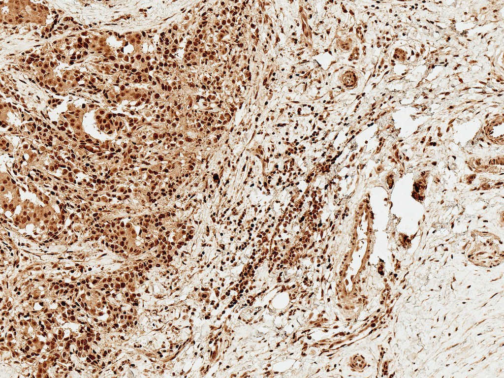  - FOXO1 Antibody ASM10639