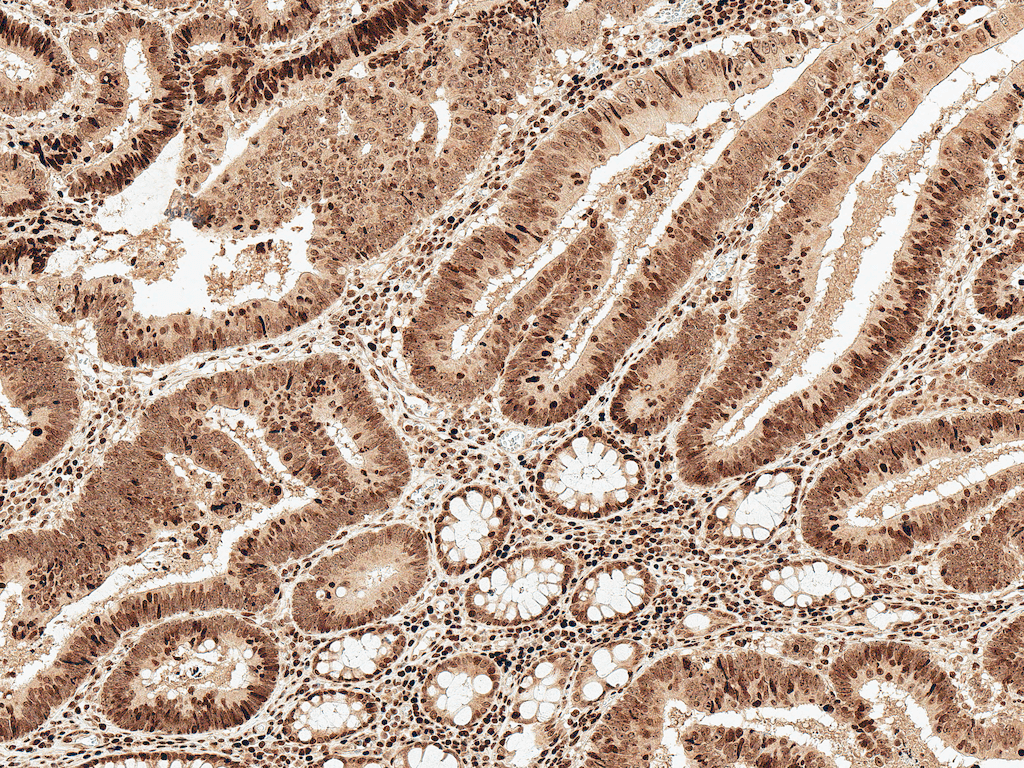  - MCL 1 Antibody ASM10640