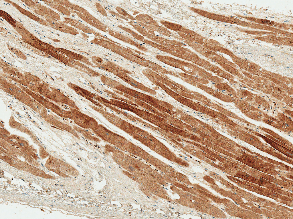  - PDGFB Antibody ASM10641
