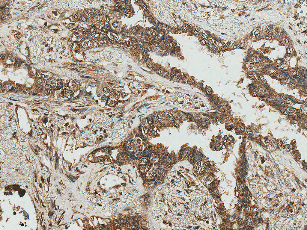  - RICTOR Antibody ASM10646
