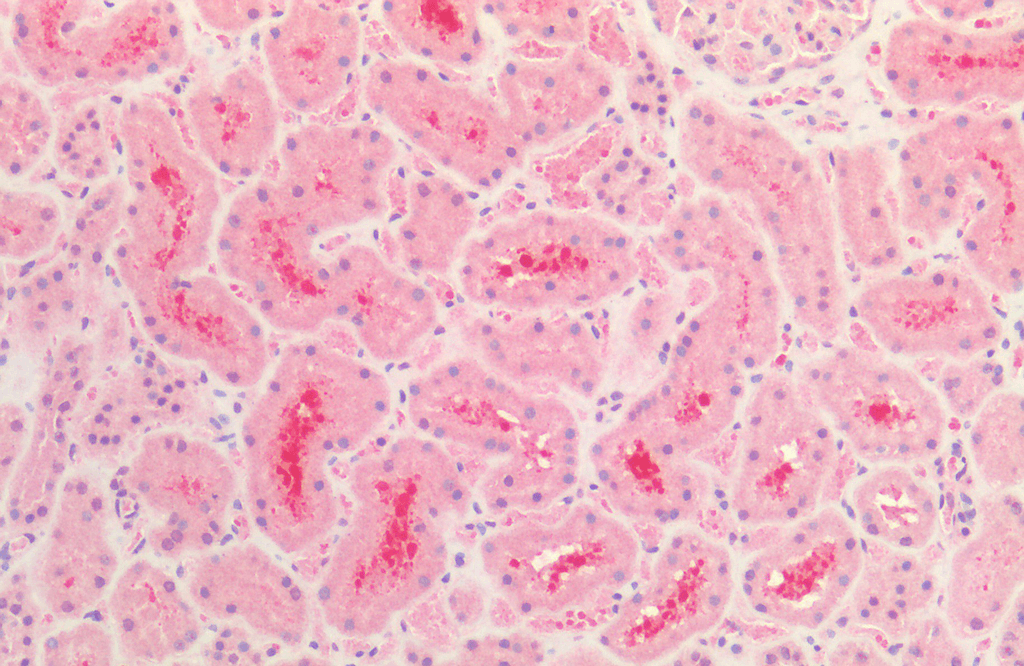  - Tau Antibody ASM10650