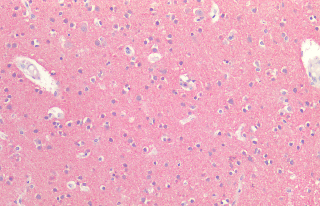  - Tau Antibody ASM10651