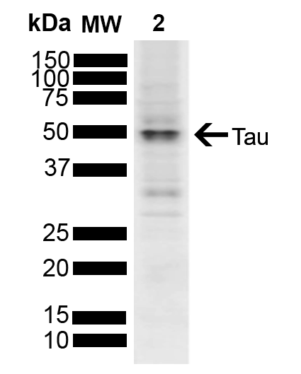  - Tau Antibody ASM10651