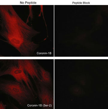  - Anti-Coronin-1B (Ser-2), Phosphospecific Antibody AN1722