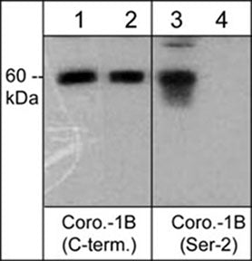  - Anti-Coronin-1B (C-terminus) Antibody AN1721