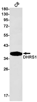 WB - DHRS1 Rabbit mAb AP75356