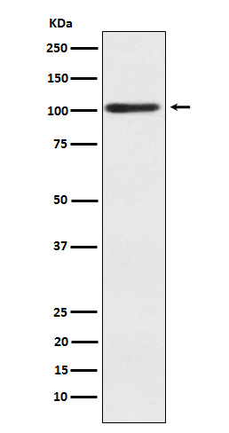 WB - Sarcomeric alpha Actinin Rabbit mAb AP78125